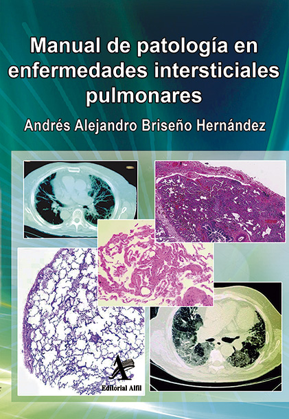 Portada de Manual de patología en enfermedades intersticiales pulmonares · Varios Autores