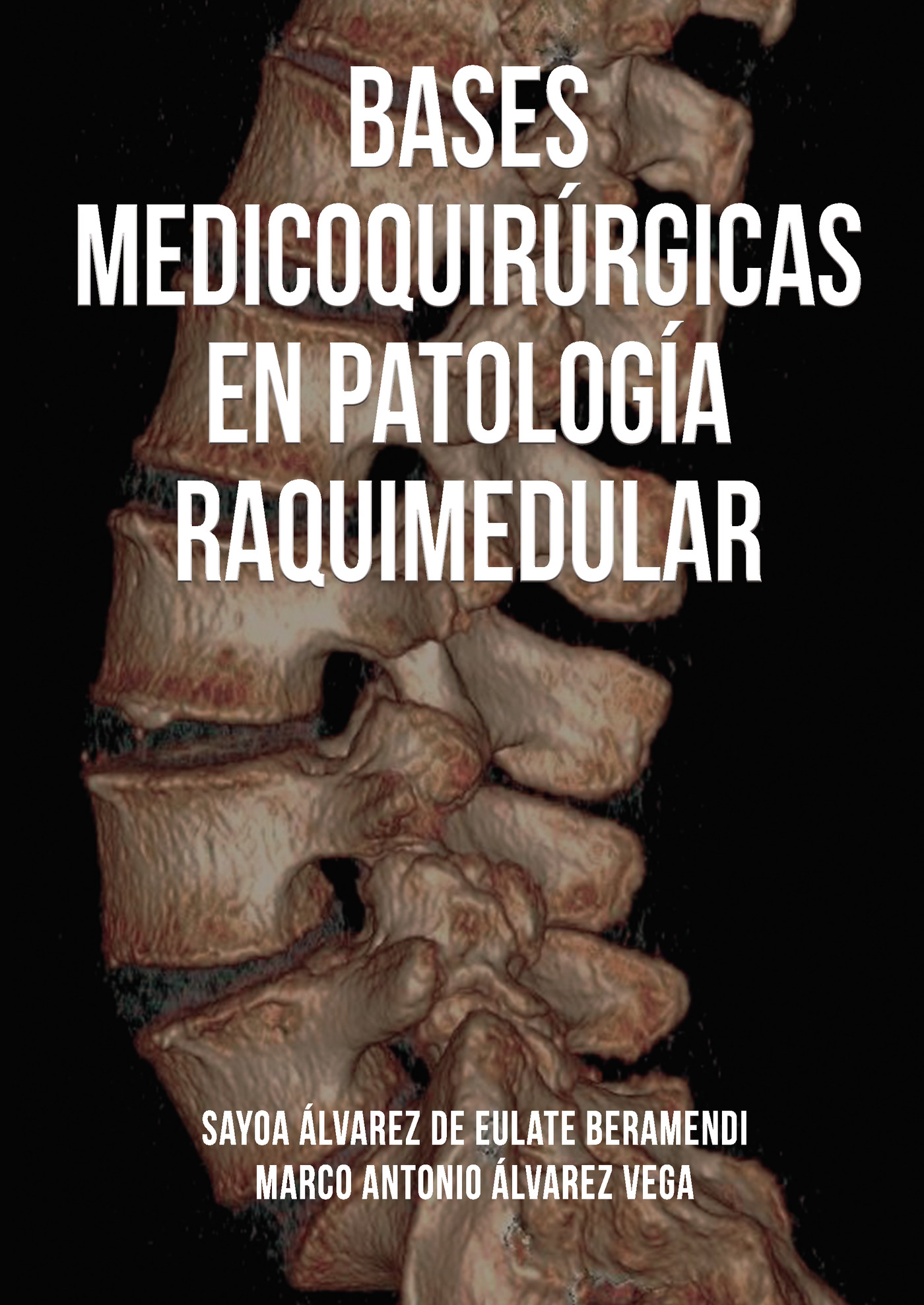 Portada de Bases medicoquirúrgicas en patología raquimedular