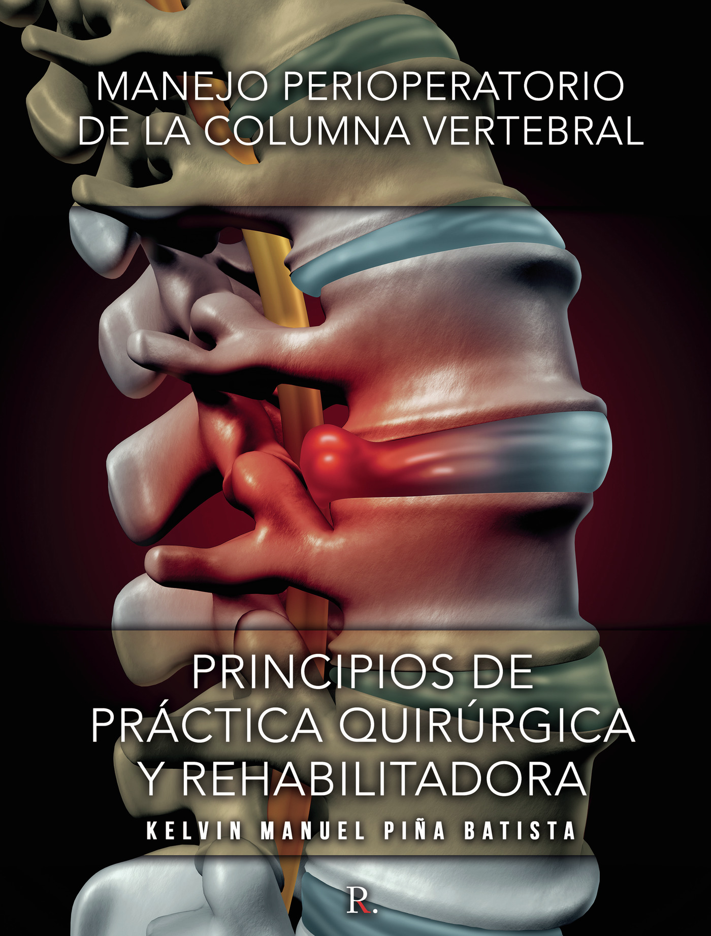 Portada de Manejo perioperatorio de la columna vertebral : PRINCIPIOS DE PRÁCTICA QUIRÚRGICA Y REHABILITADORA