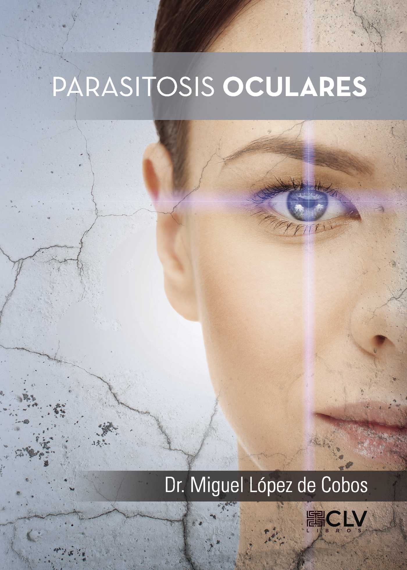 Portada de Parasitosis oculares