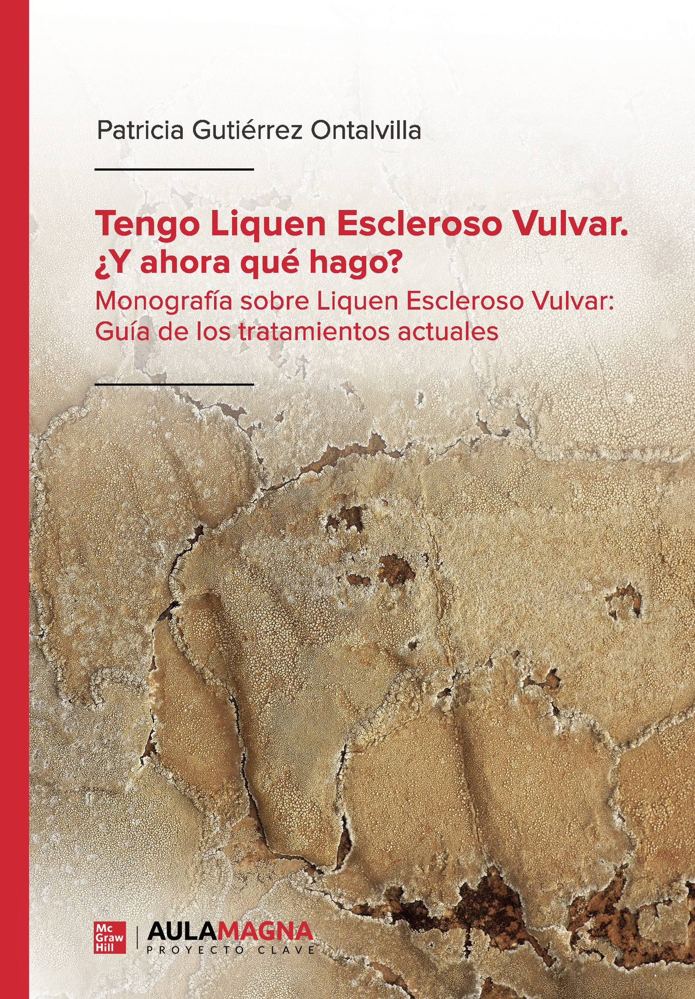 Portada de Tengo Liquen Escleroso Vulvar. ¿Y ahora qué hago? · Patricia Gutiérrez Ontalvilla