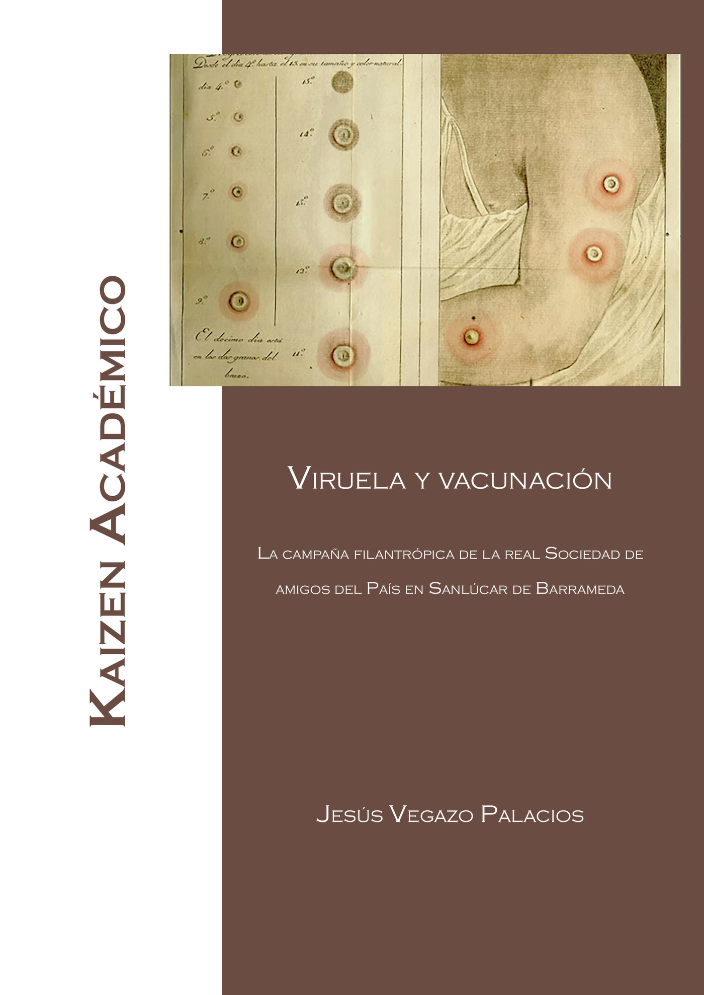 Portada de Viruela y vacunación. La campaña filantropica de la Real Sociedad Económica de Amigos del País de Sanlúcar de Barrameda · Jesús Vegazo Palacios