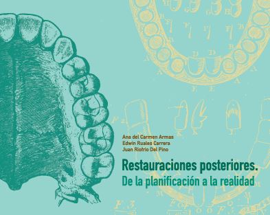 Portada de Restauraciones posteriores