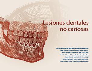 Portada de Lesiones dentales no cariosas