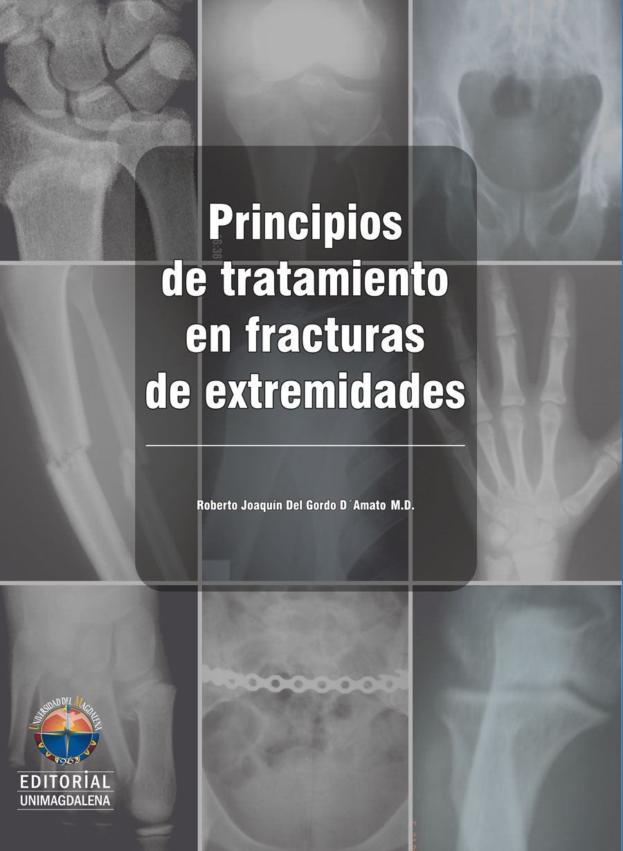 Portada de Principios de tratamiento en fracturas de extremidades